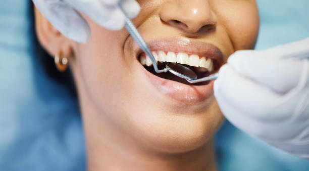 Best Emergency Dental Services for Seniors in Farmington, IL