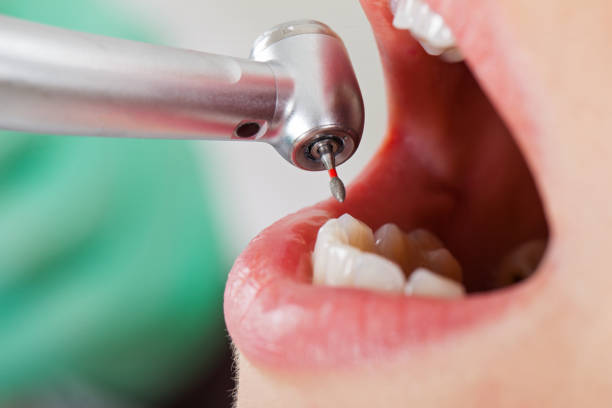 Best Pediatric Emergency Dentist in Farmington, IL